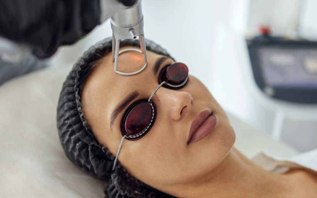 Laser Resurfacing Consultation in Bethesda, Maryland